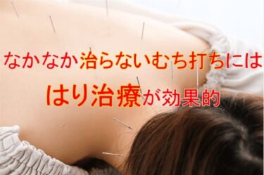 なかなか治らないむち打ちには『はり治療』が効果的